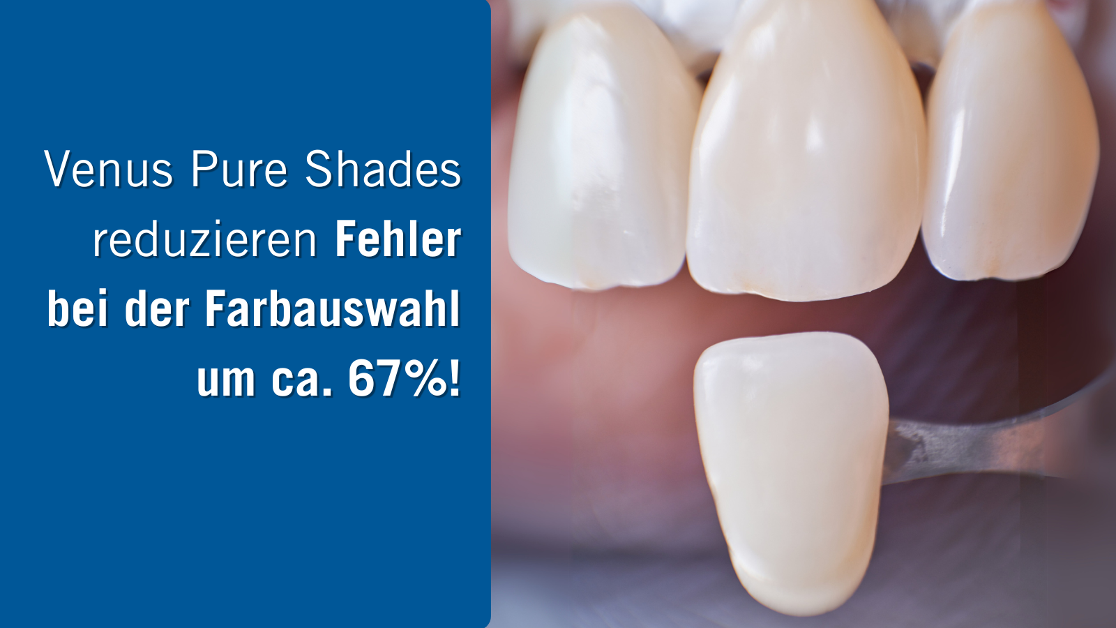 Studie bestätigt: Vereinfachte Schichtung, überzeugende Ergebnisse