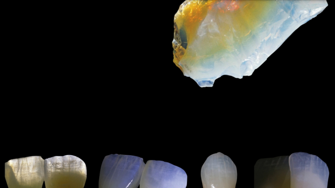 Opalschneiden ersetzen in der MatrixSchichtung die entsprechenden Standardschneiden