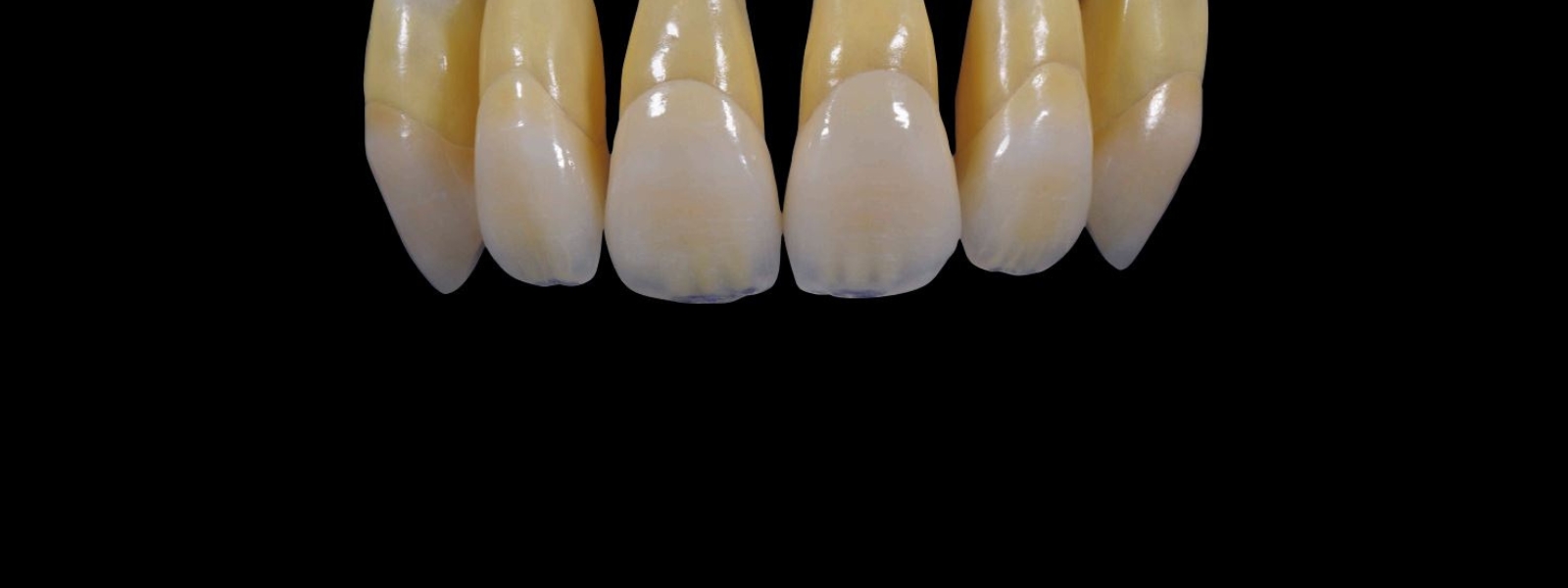 Kulzer HeraCeram Matrix Schichtsystem Schauarbeit Verblendkeramik