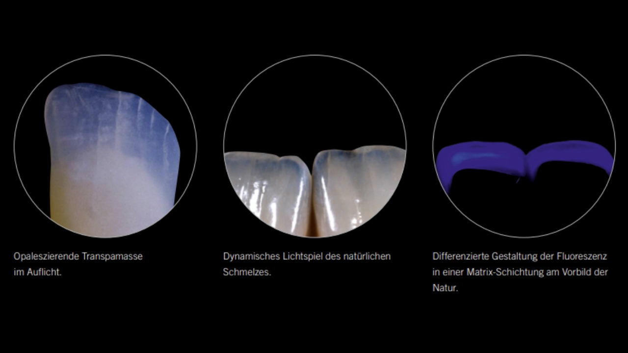 Keramische Verblendung im Zusammenspiel aus Transluzenz Opaleszenz und Fluoreszenz