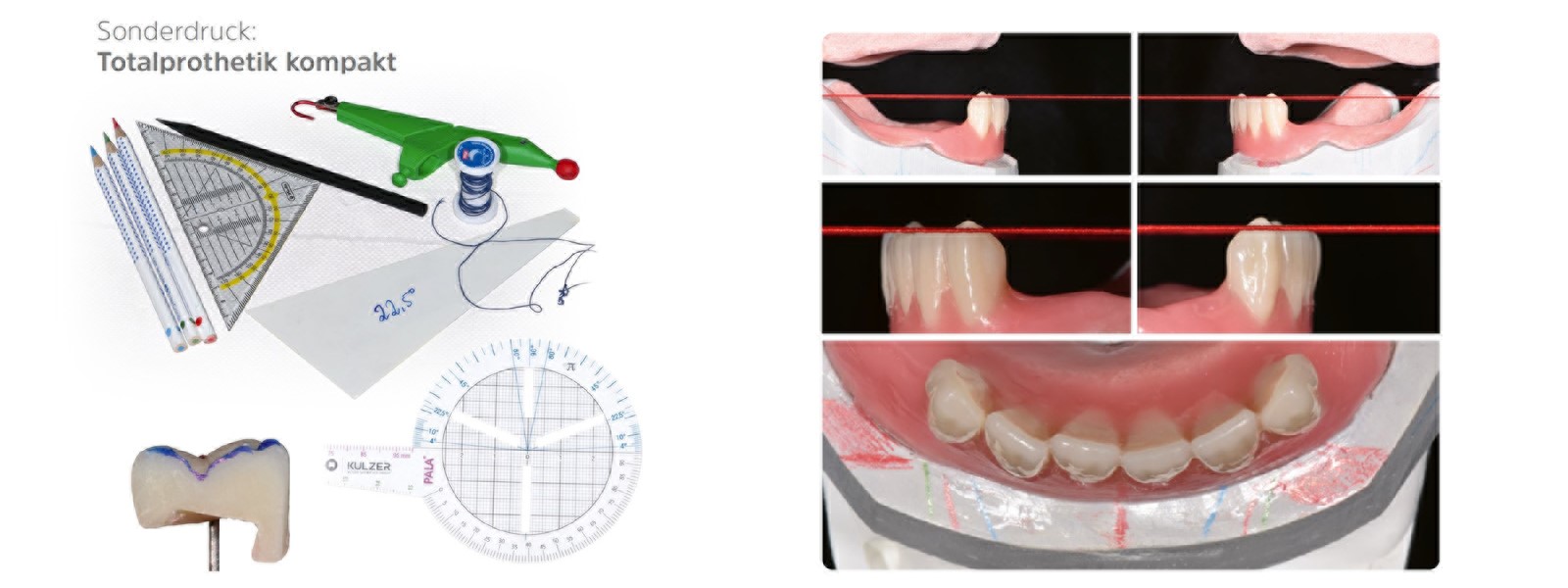 Totalprothetik Kompakt
