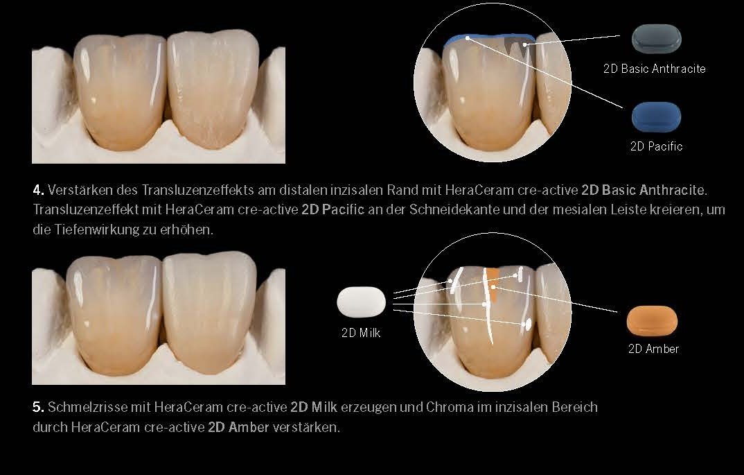 personalised Staining concept