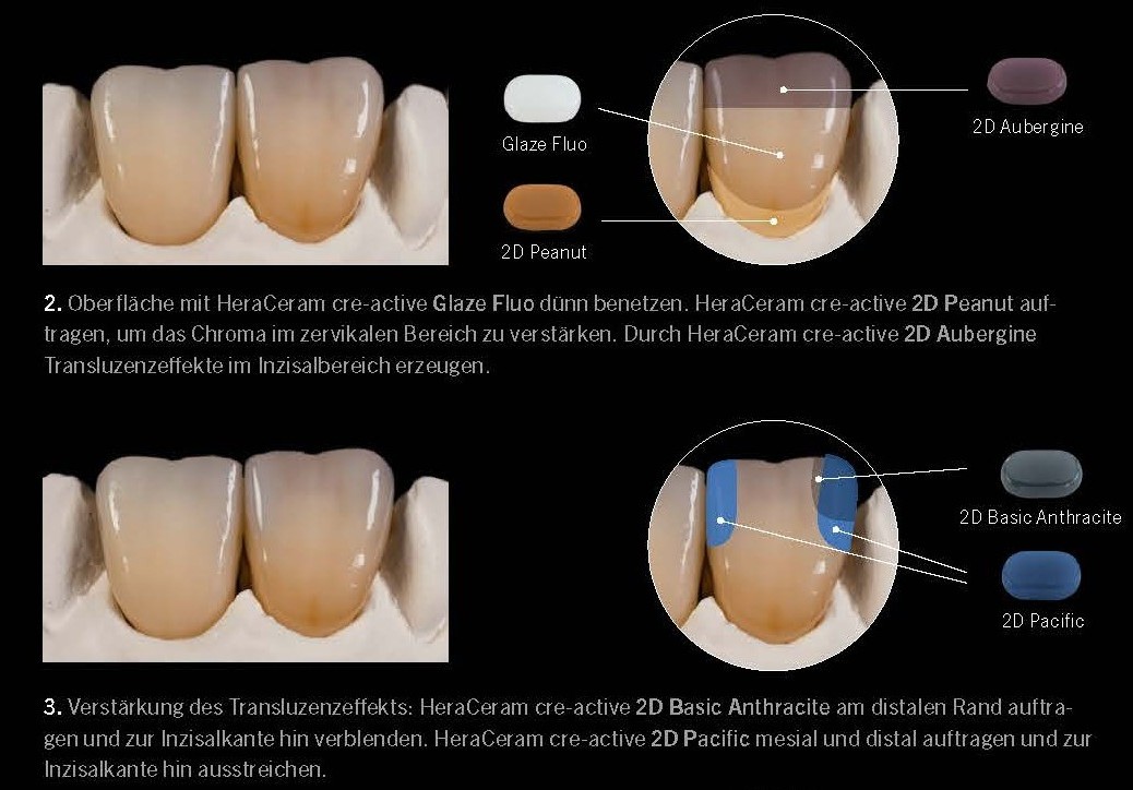 Standard Staining concept
