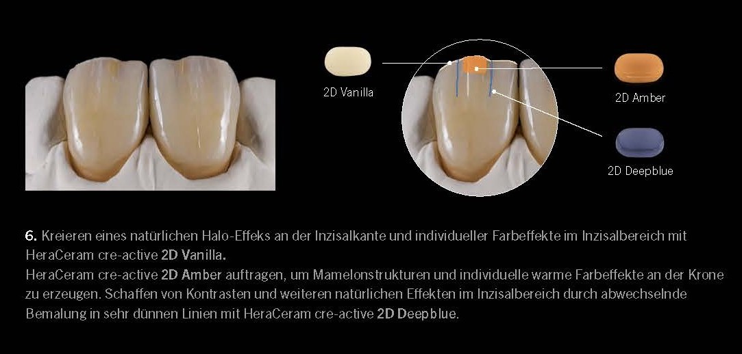 Hybrid Micro-Layering