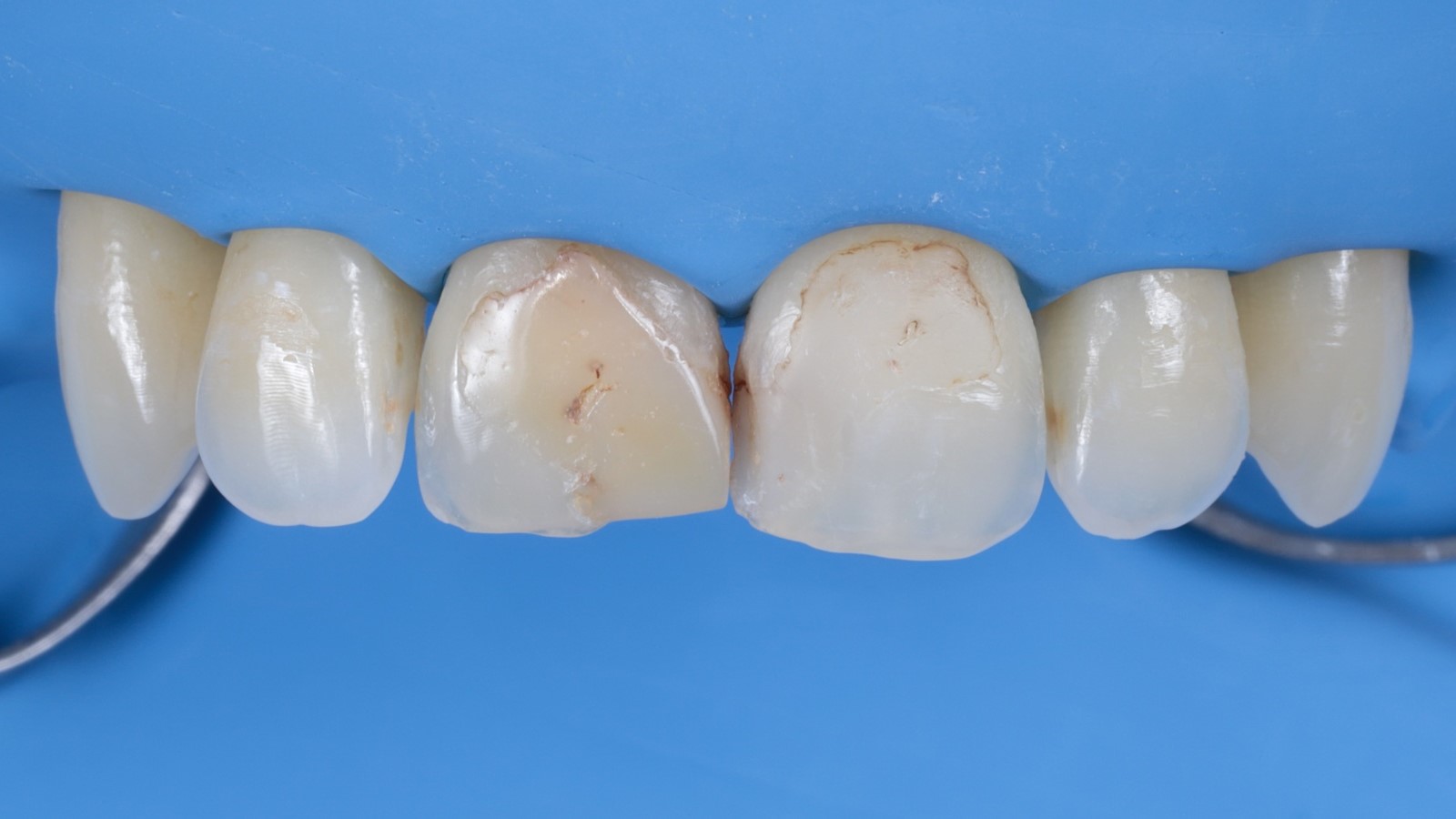 Isolation of the operating field