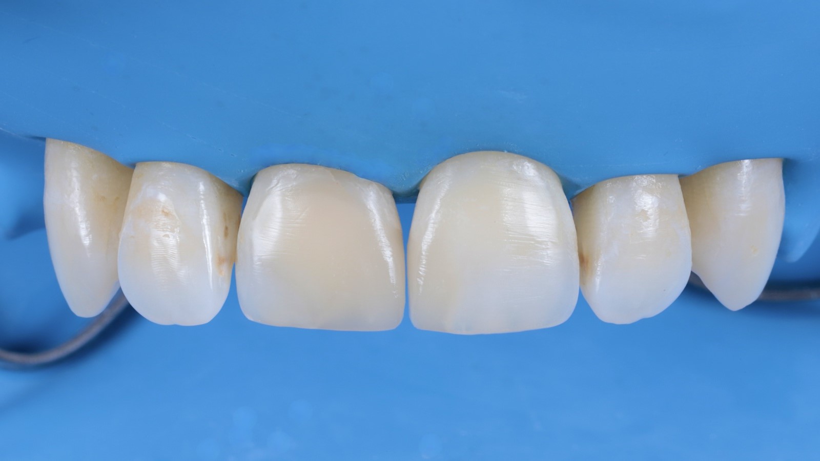 Restorations directly after polishing