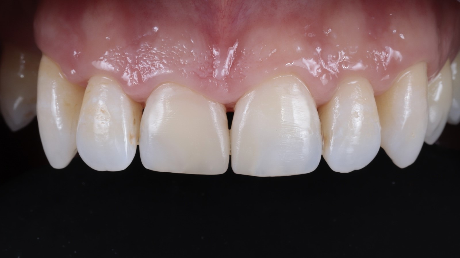 Final result after rehydration