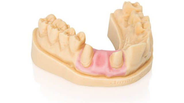 3D-Harz für die 3D-Herstellung von Zahnmodellen