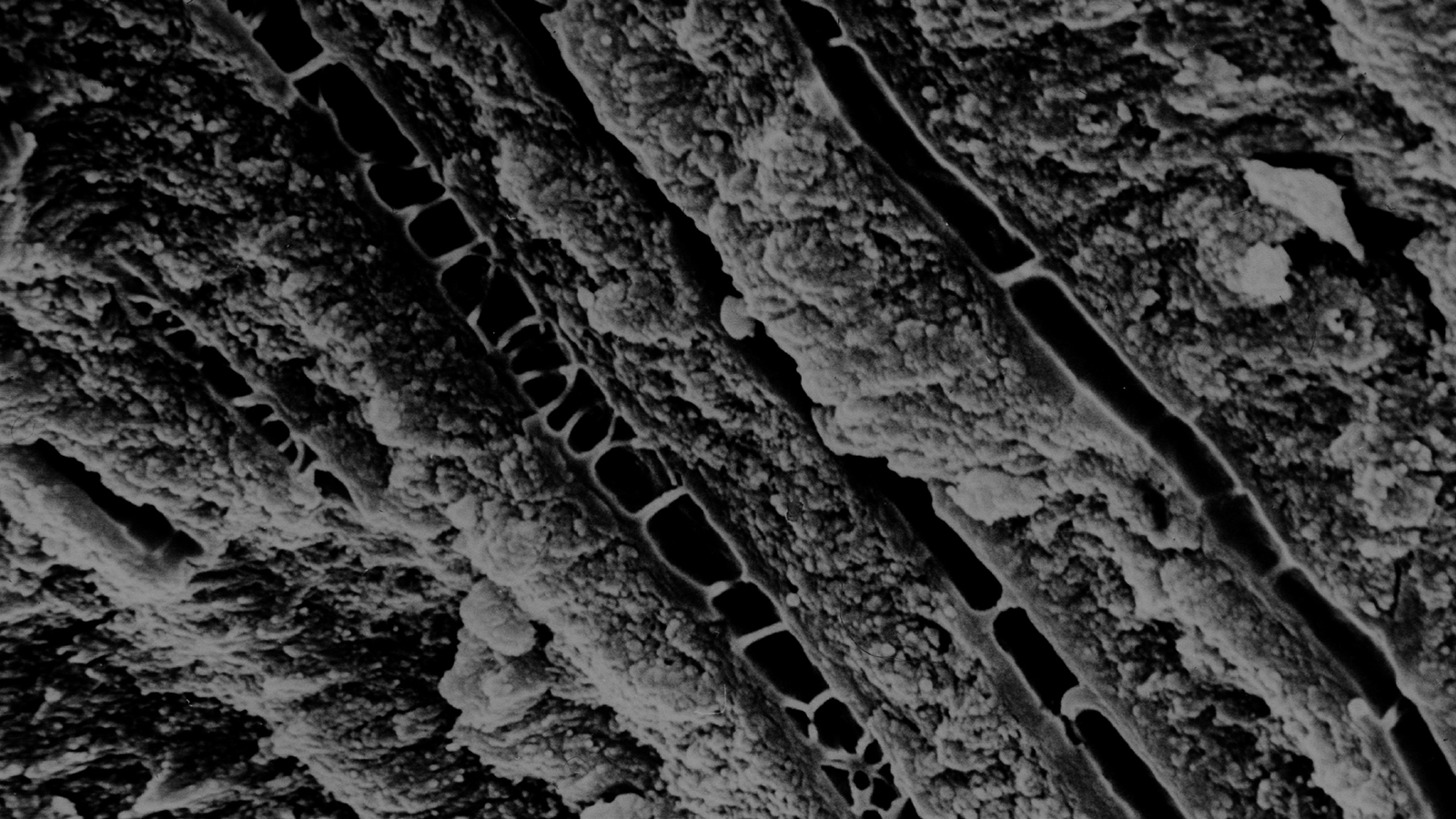 Image dentinal tubuli