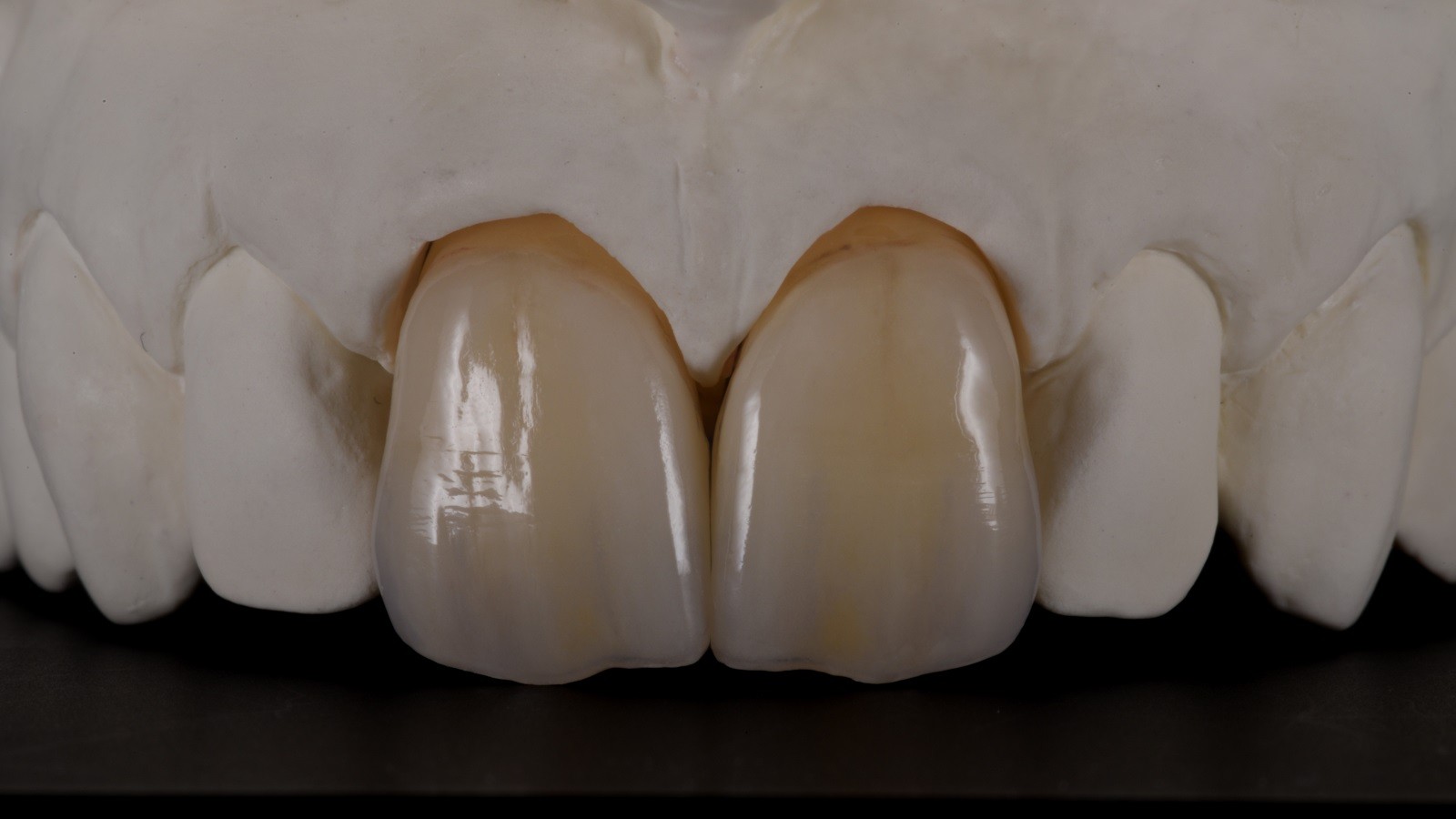 Exzellente Ergebnisse mit Micro-Layering Exzellente Ergebnisse mit Micro-Layering