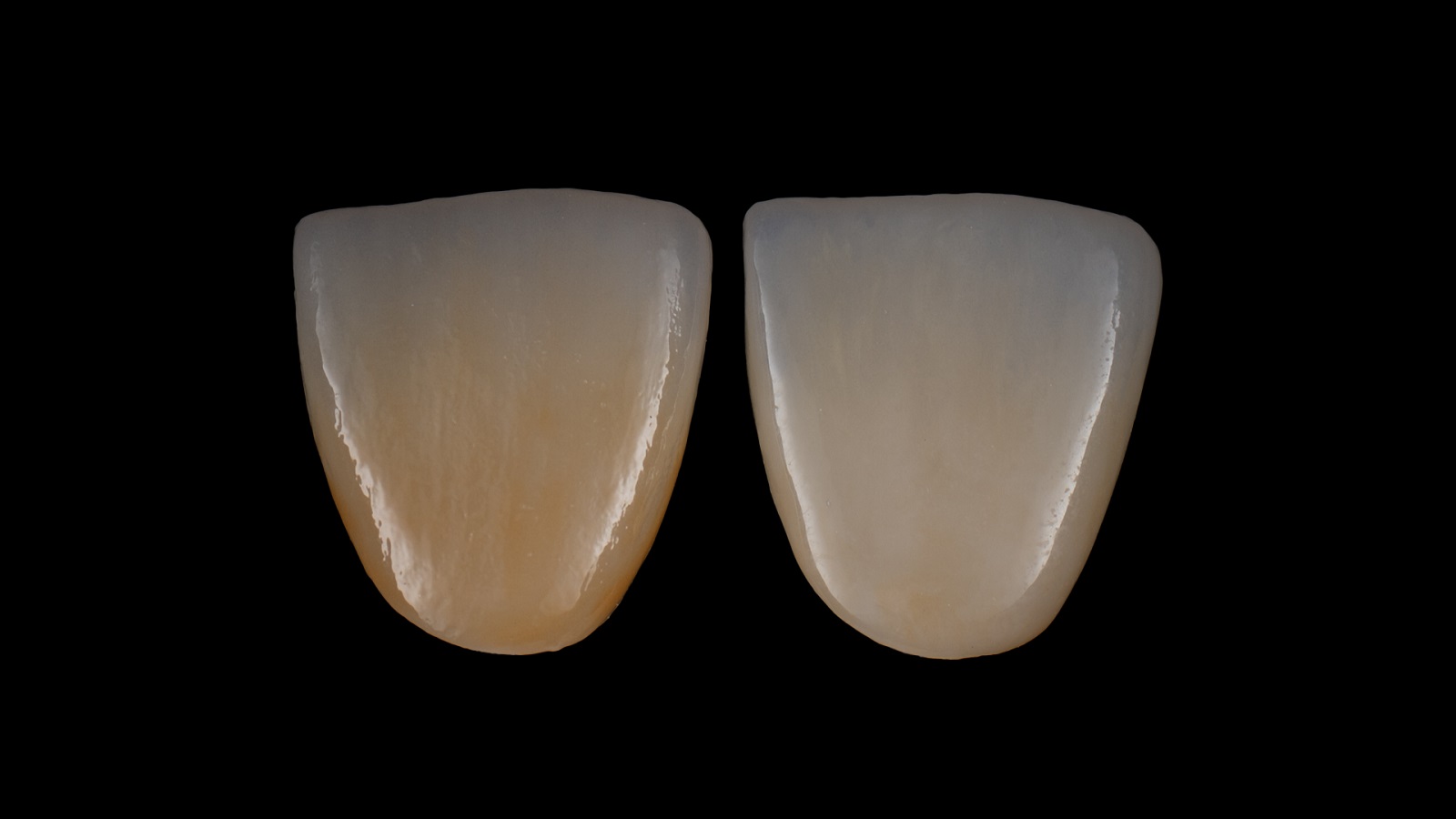 Erhöhen Sie ganz einfach die Helligkeit Ihrer Restauration mit HeraCeram cre-active 2D EH Bright