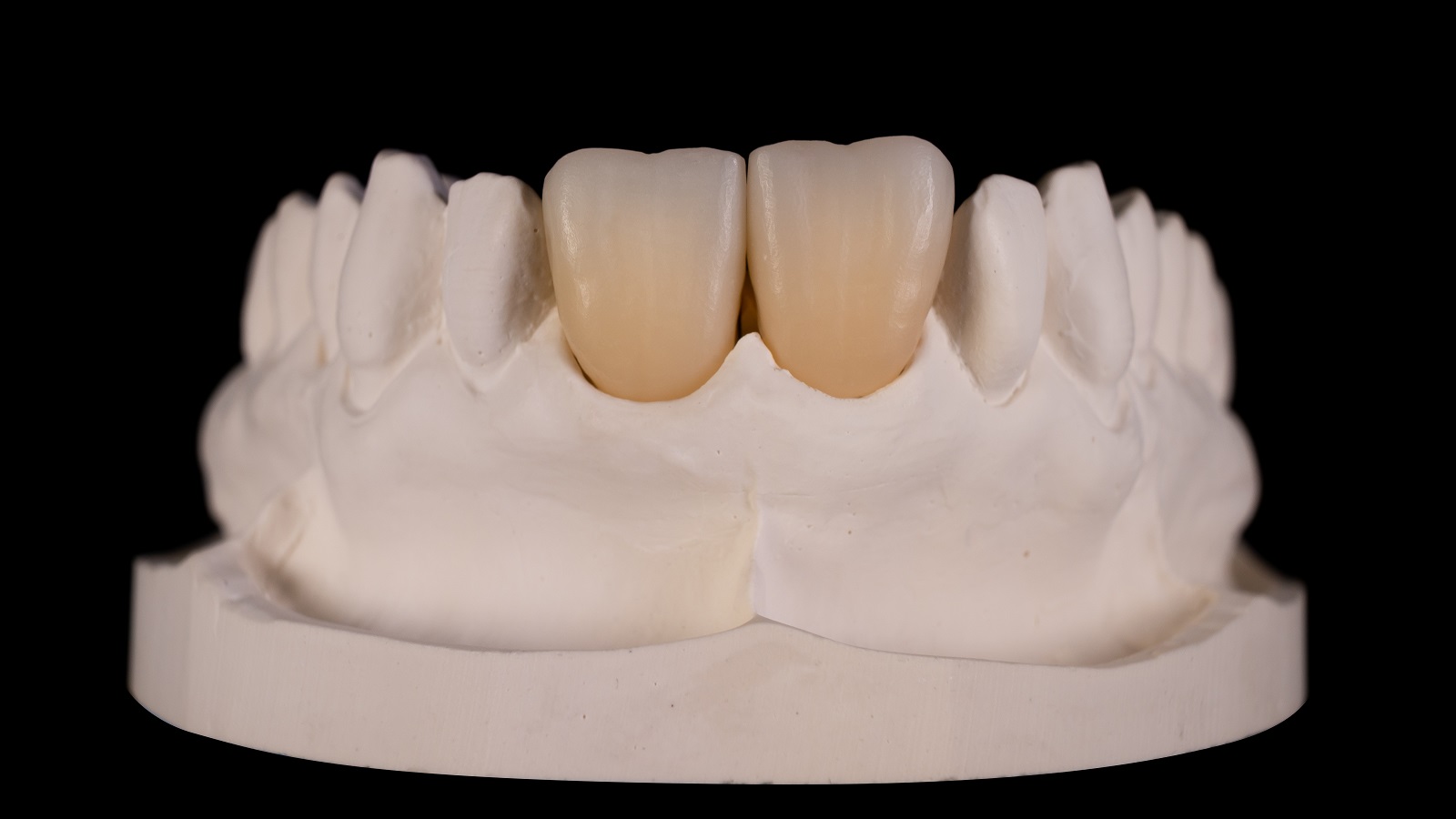 Zirconia multi-layer frames - ready for individualisation 