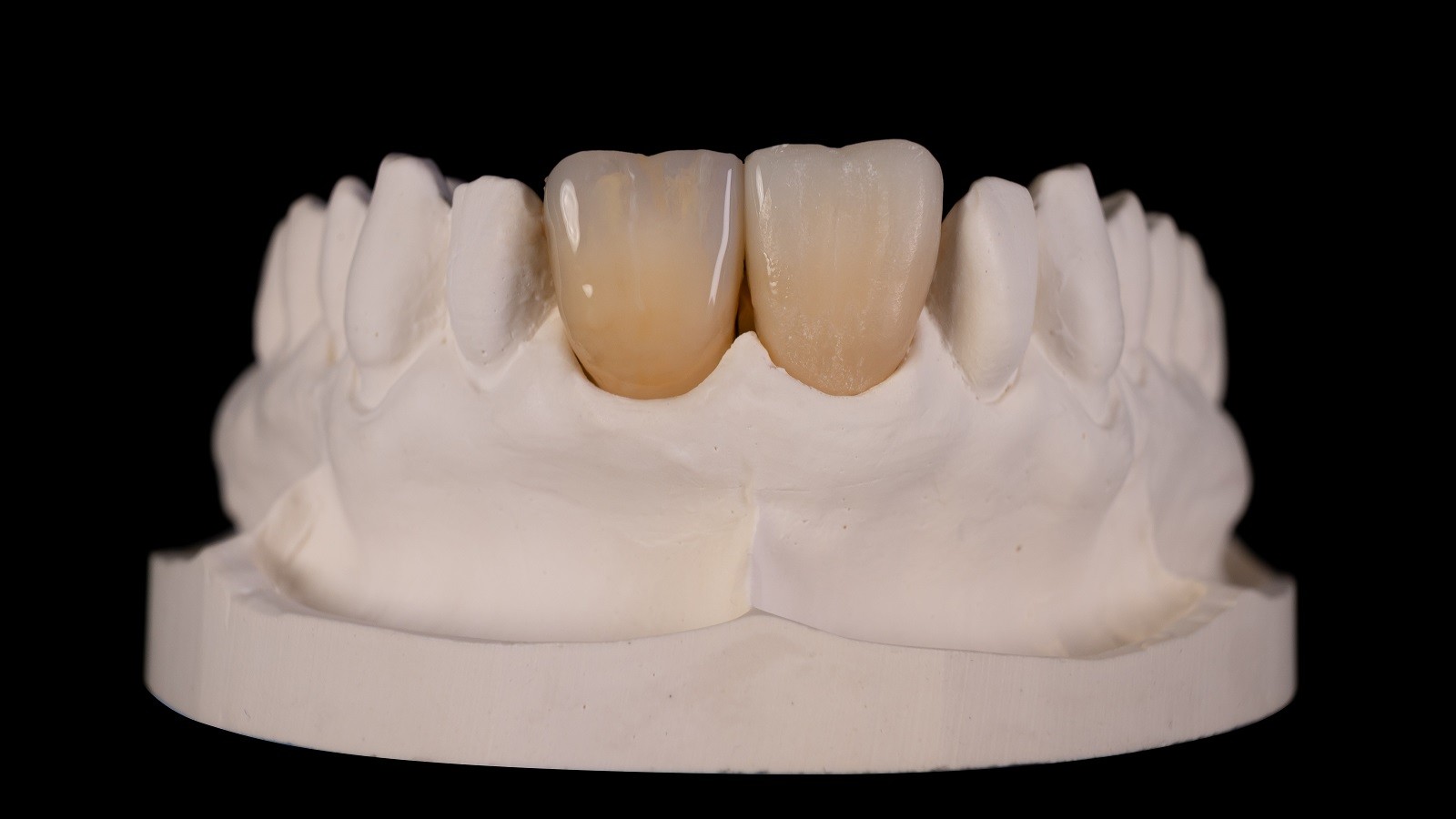 Translucency and contrast in incisal area adjustment