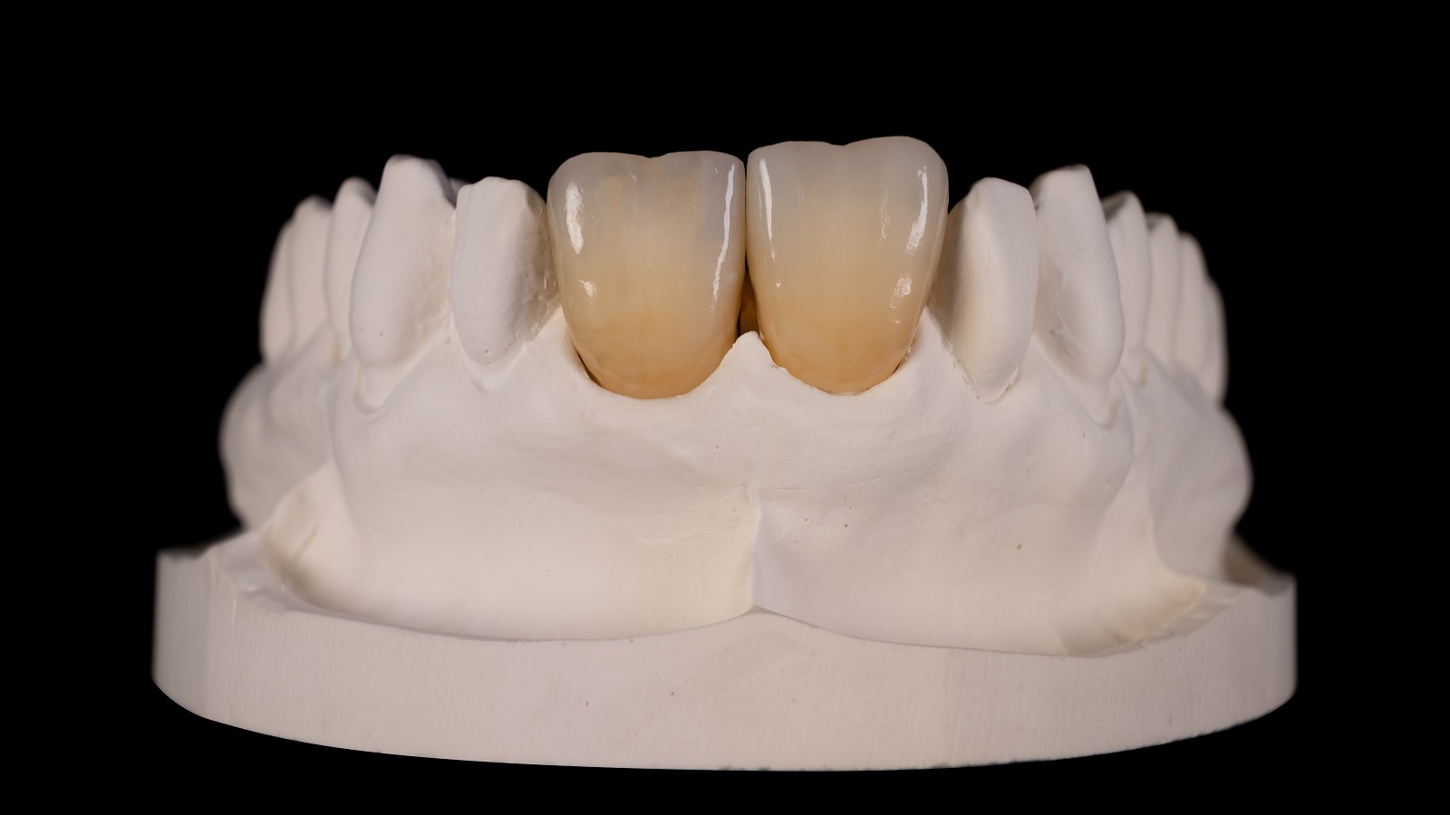 Links: individuell - rechts: standard Schichtung