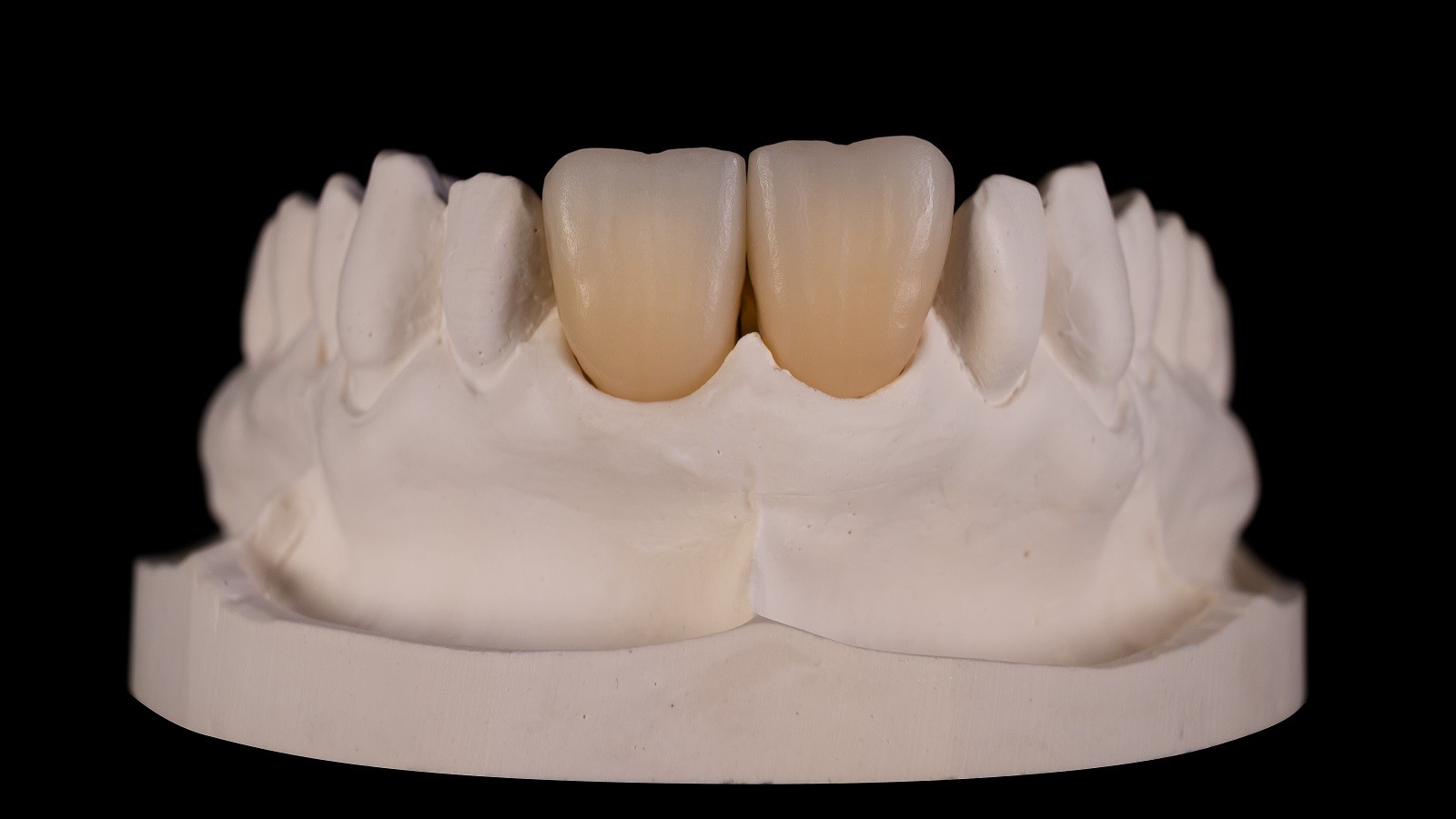 Zirconia multi-layer frames in A3 - ready for individualisation