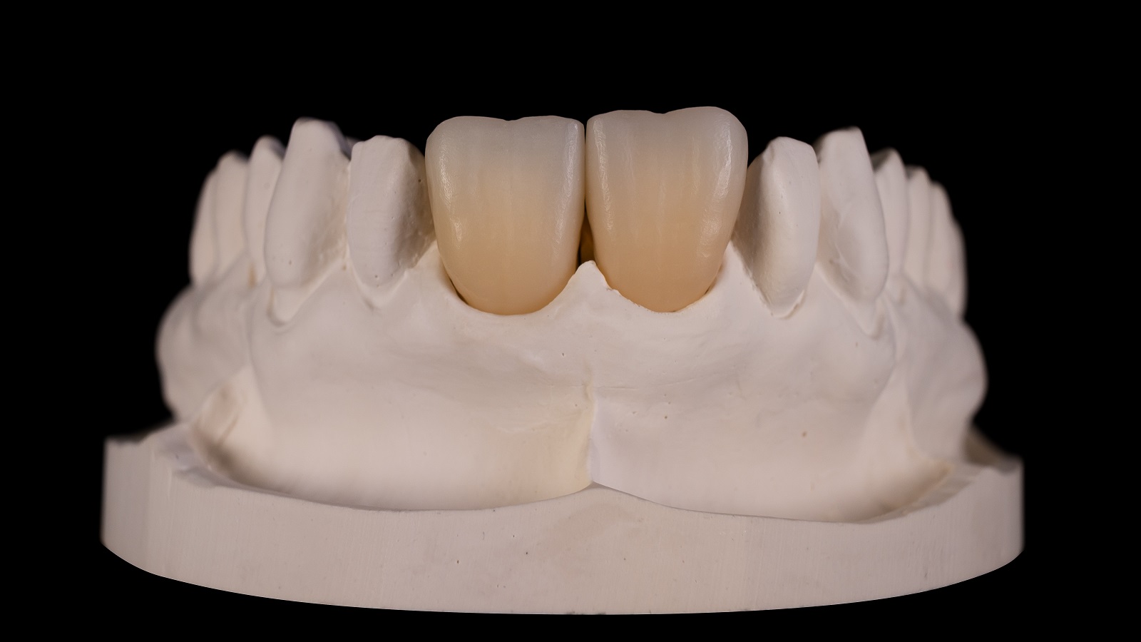 Zirconia multi-layer frames in A3 - ready for individualisation