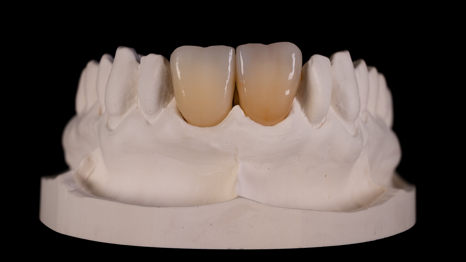 Adapt tooth colour with HeraCeram cre-active 2D Body A in dentin area.