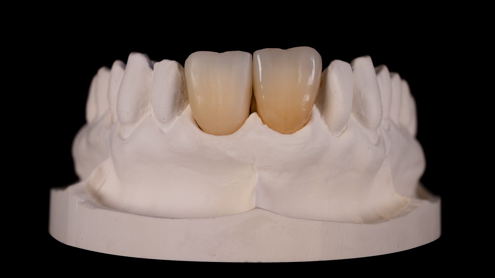 Final result after HeraCeram cre-active 2D firing.