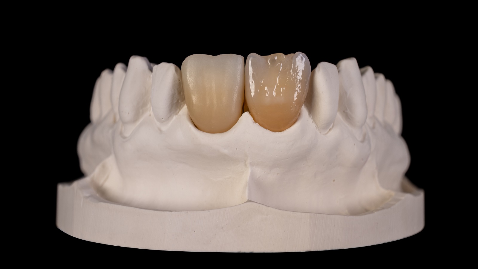 HeraCeram cre-active - Magic matrix concept