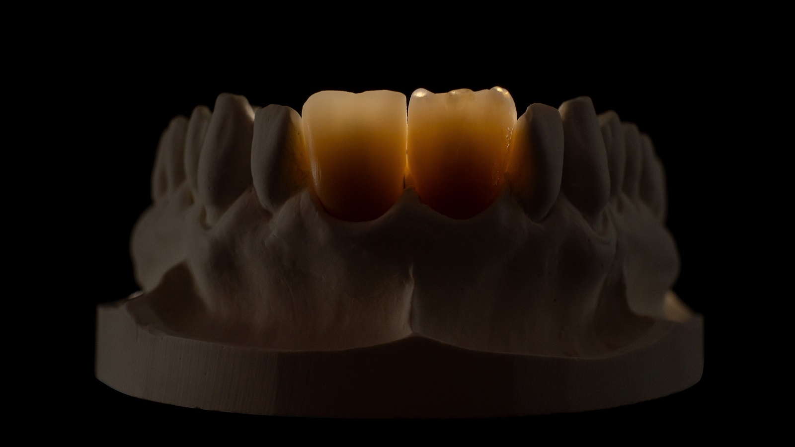 HeraCeram cre-active - Magic matrix concept
