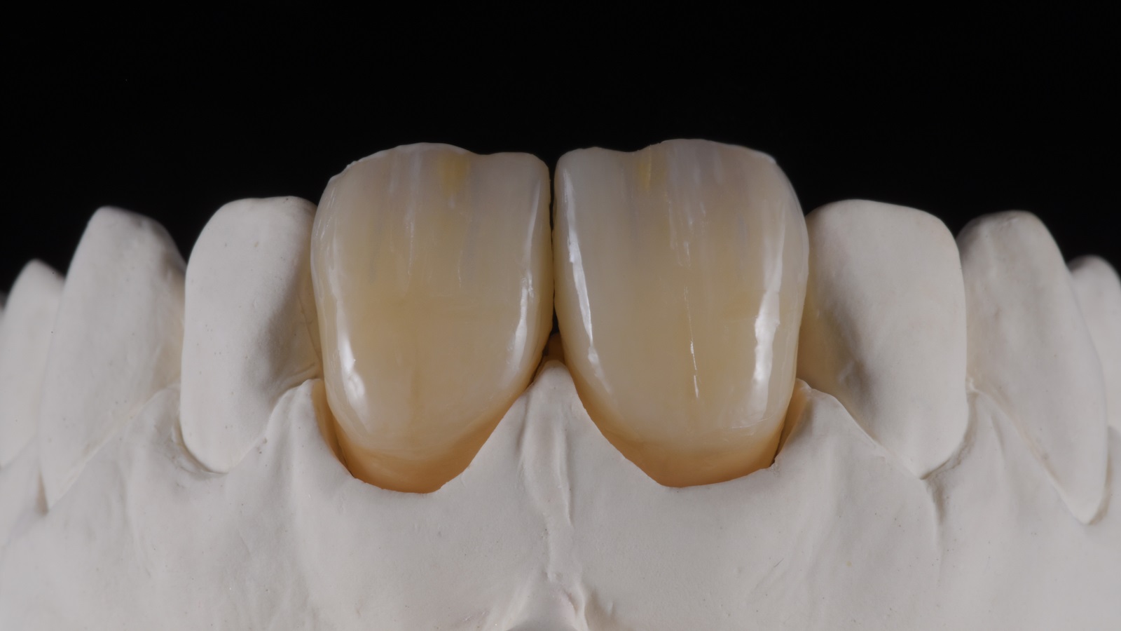 HeraCeram cre-active - take two concept