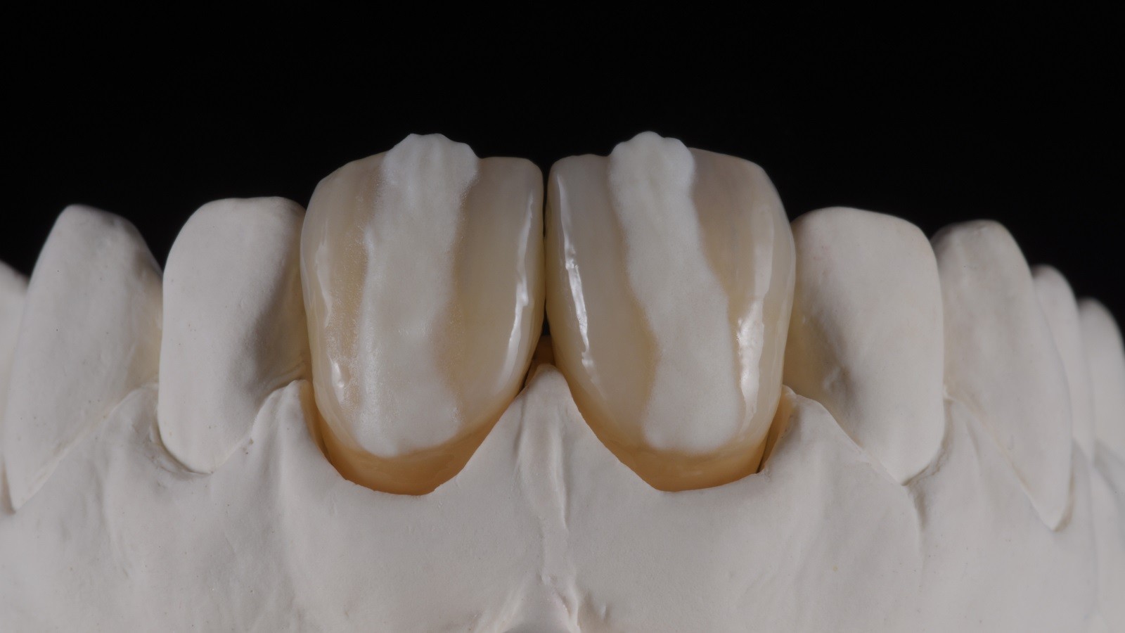 HeraCeram cre-active - take two concept