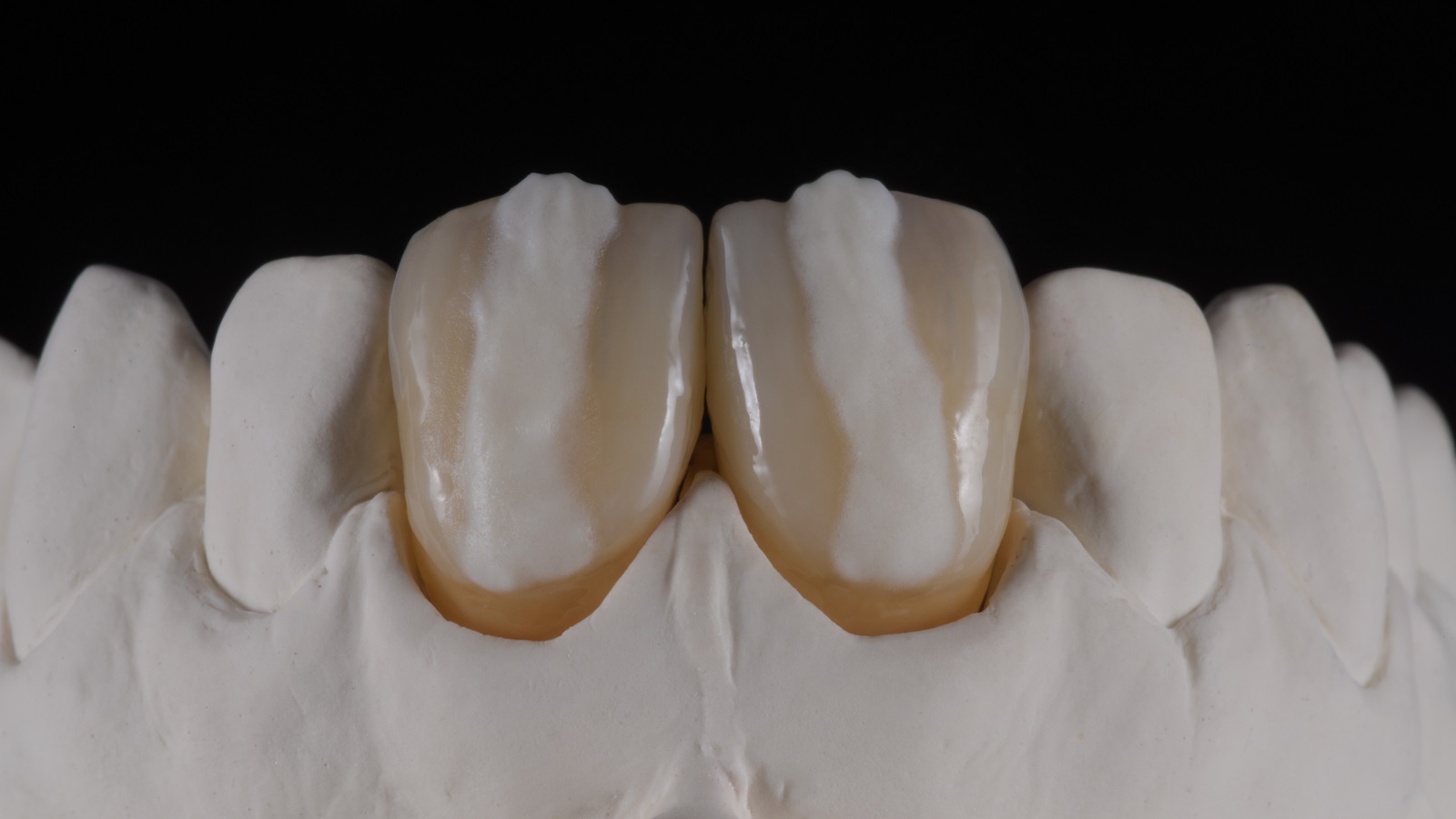 HeraCeram cre-active - take two concept