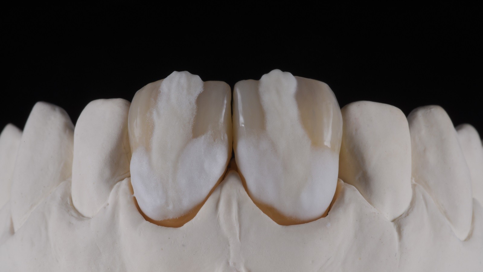 HeraCeram cre-active - take two concept