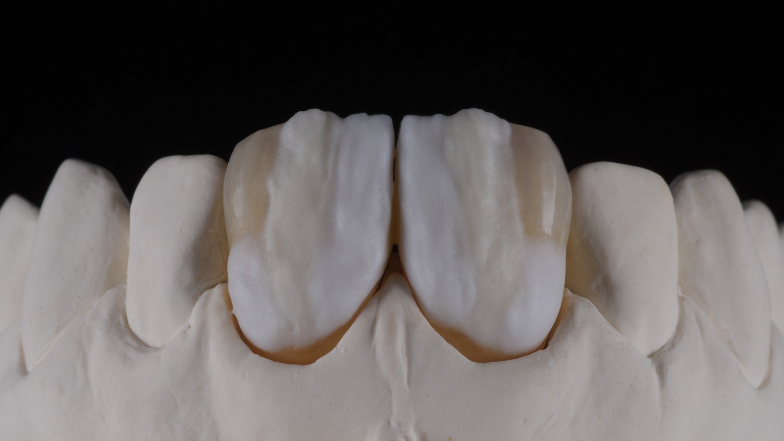 HeraCeram cre-active - take two concept