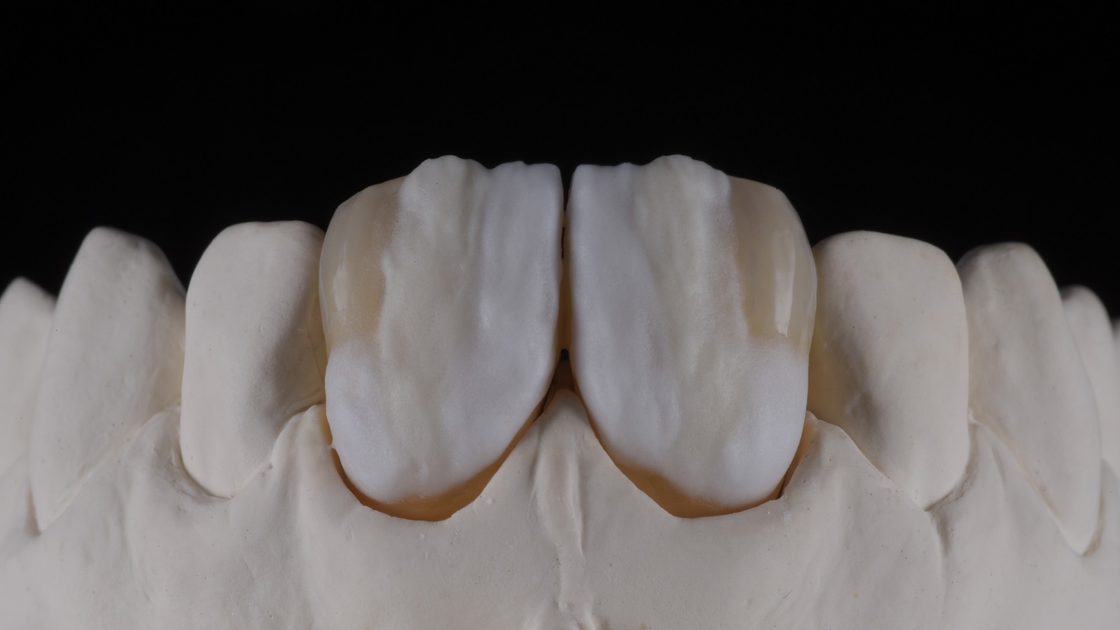HeraCeram cre-active - take two concept