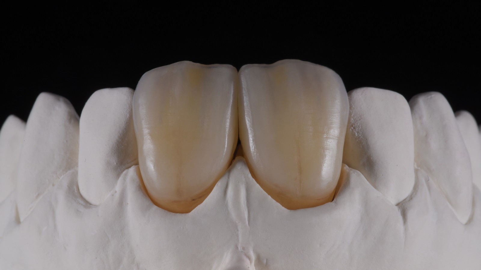 HeraCeram cre-active - take two concept