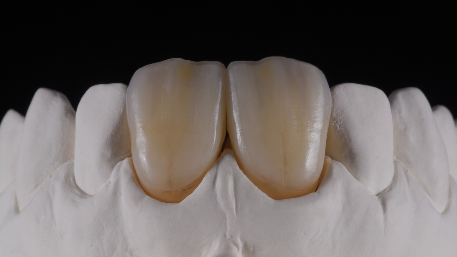 HeraCeram cre-active - take two concept