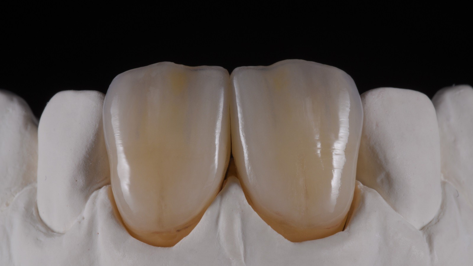 HeraCeram cre-active - take two concept