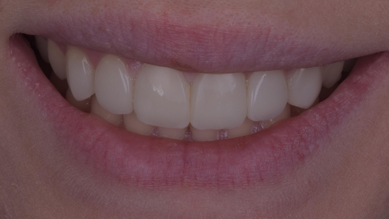 Result after 4 years, prior to a quick repolish