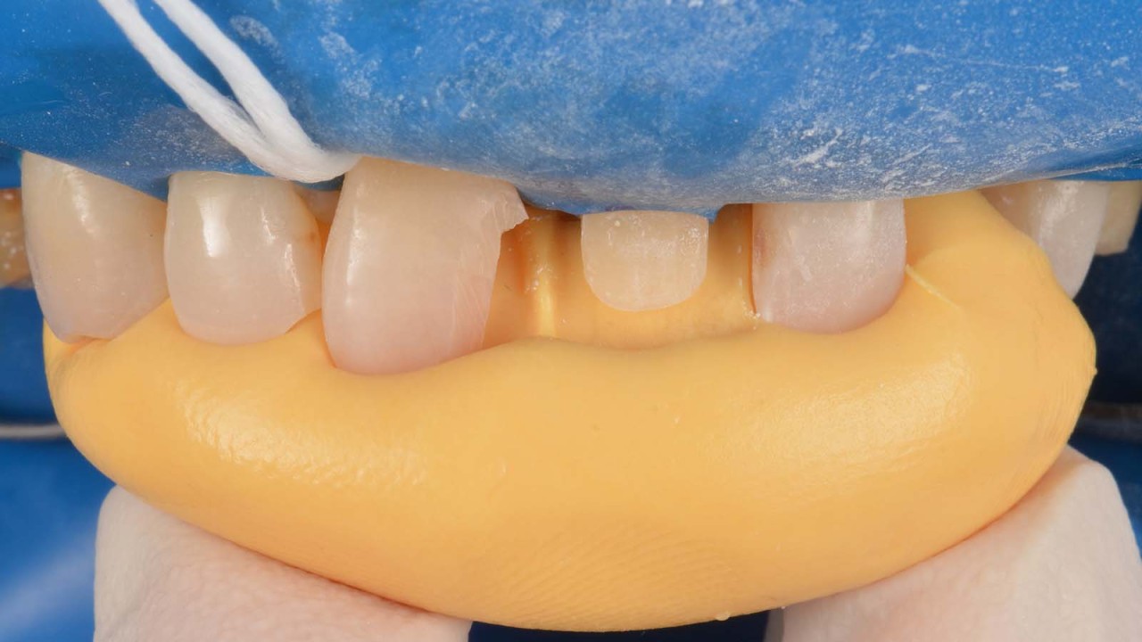 Prepared cavity